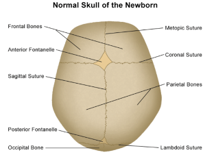 lambdoid suture x ray